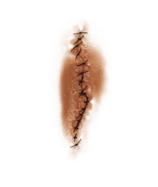 Dynamic Sutured Wound 1