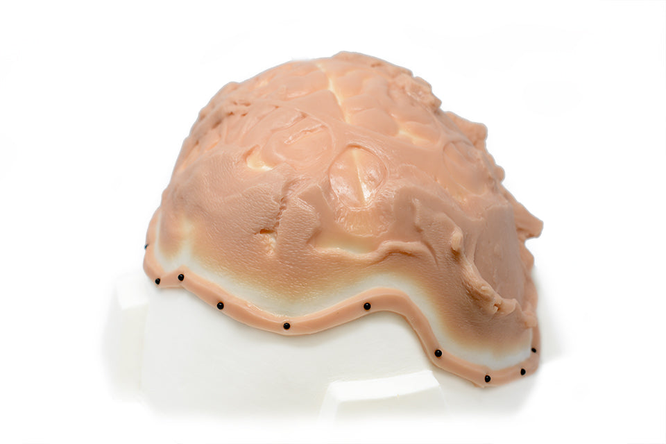 Exposed Brain Trauma
