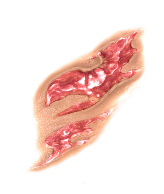 Large Body Tear 3
