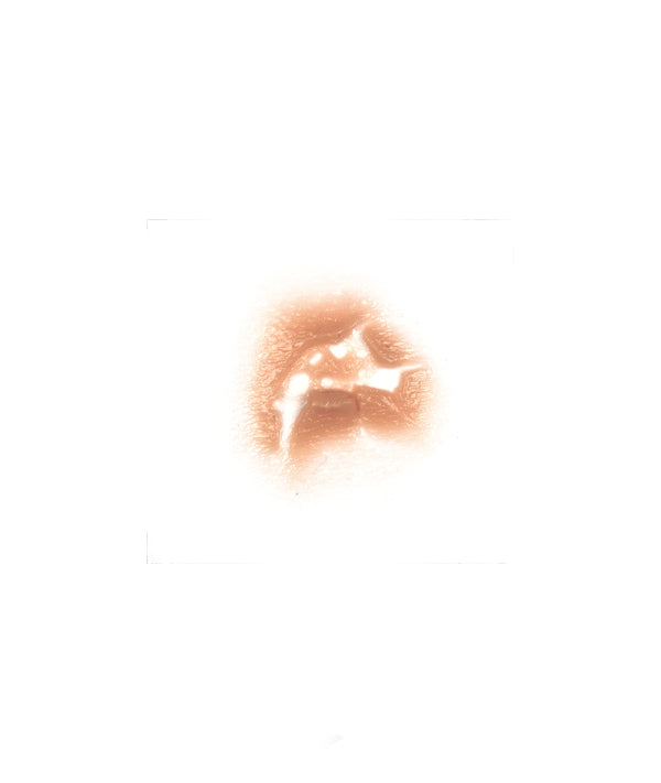 Tear 10