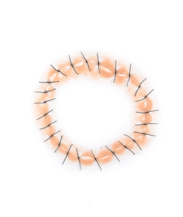 Circular Shaped Sutured Wound