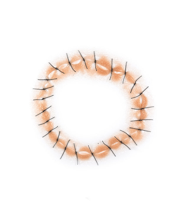 Circular Shaped Sutured Wound