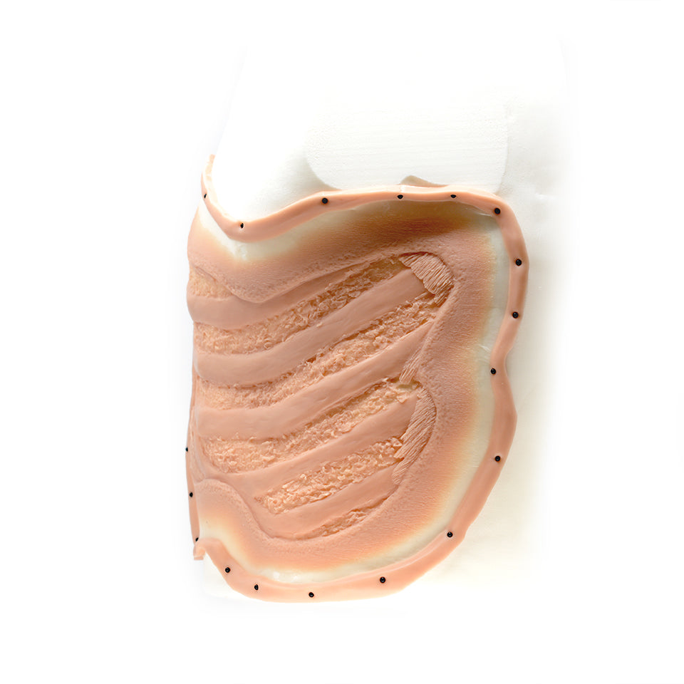 Exposed Male Ribs