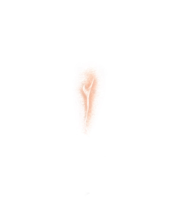 Scratch 2