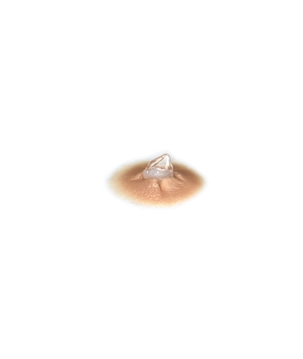 Glass Shrapnel Wound Medium