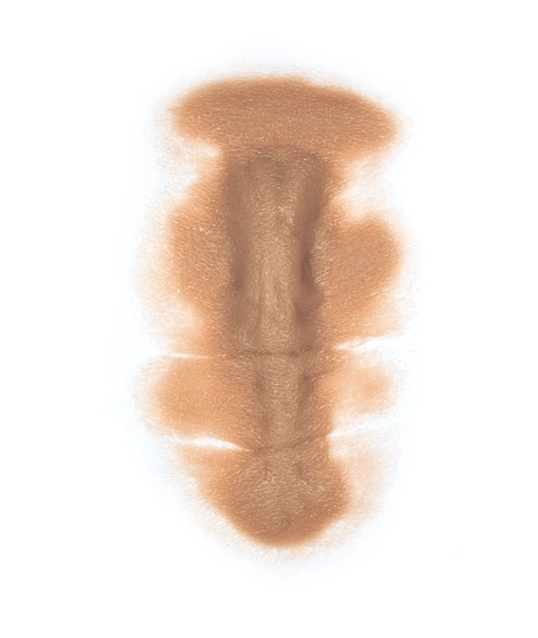 Male Neck Waddle 8