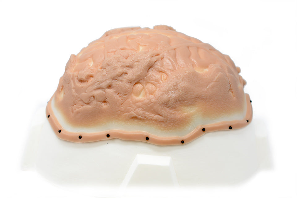 Exposed Brain Trauma
