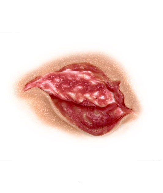 Medium Body Tear