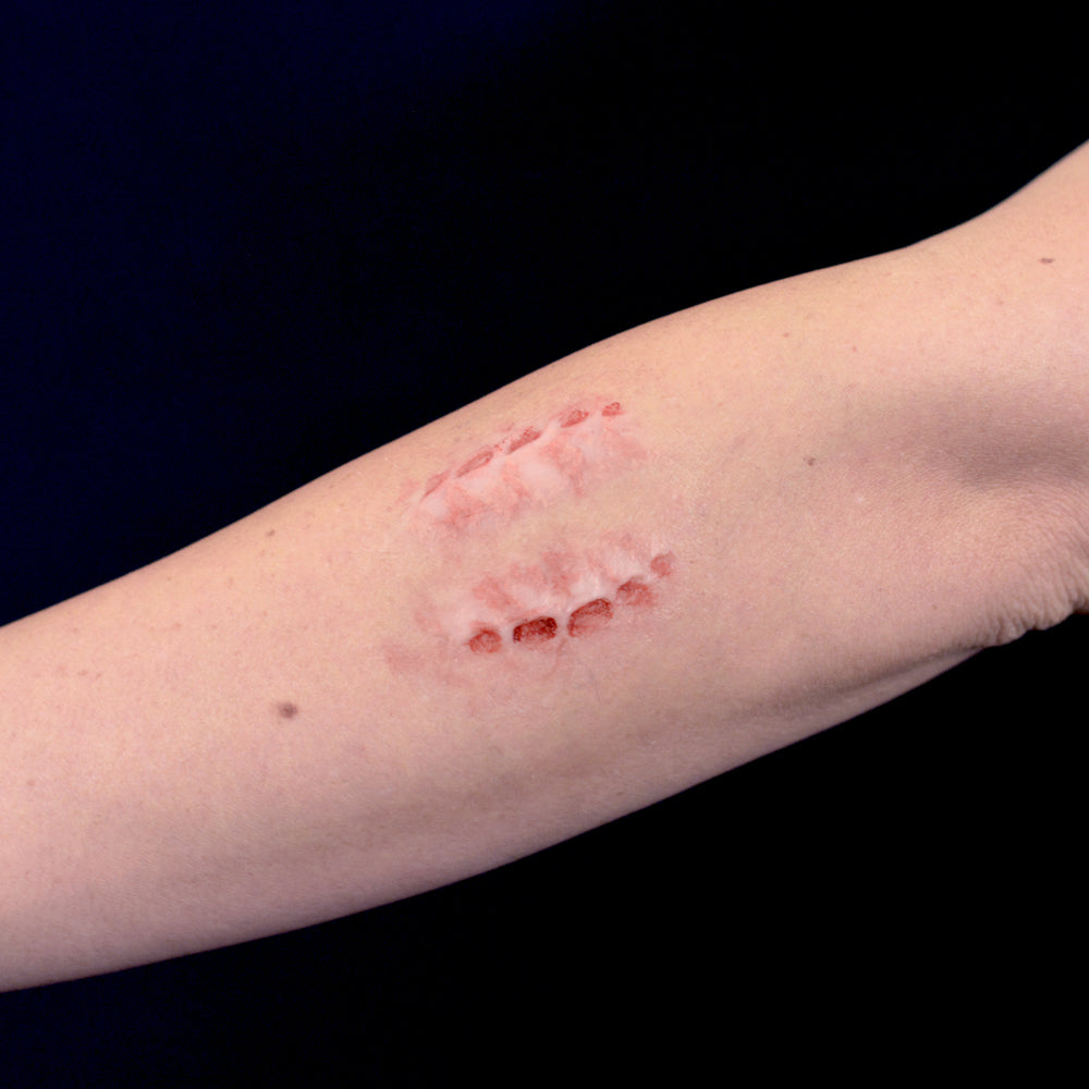 Bite Marks On Neck bite-marks-on-neck