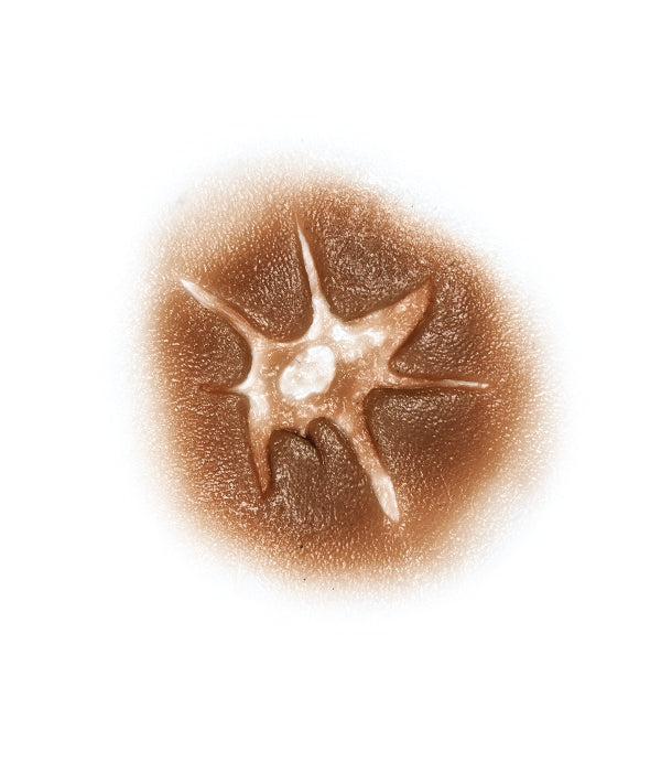 Firearm Injury