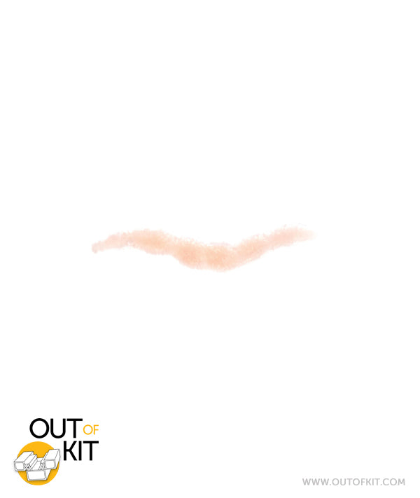 Facial Suture Wound Scar