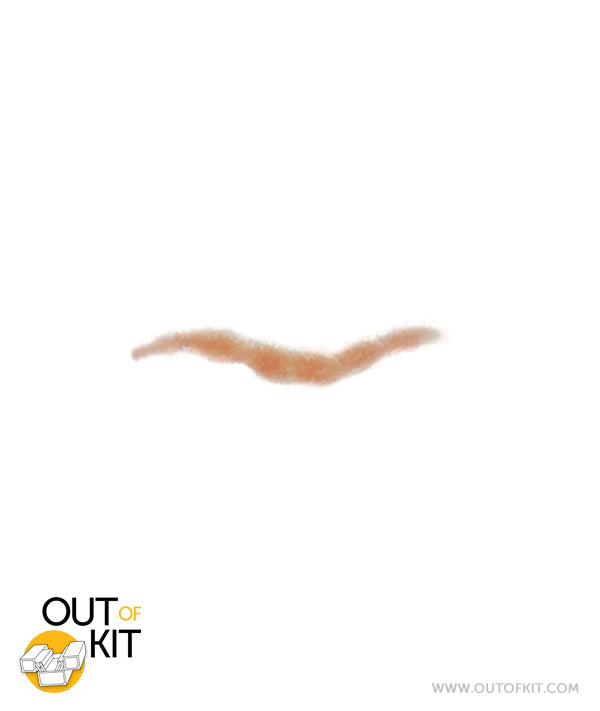 Facial Suture Wound Scar