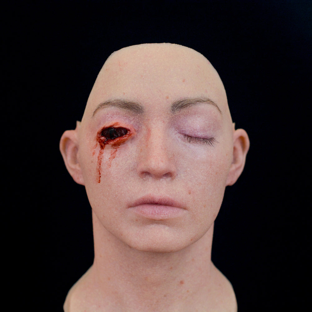 Gouged Right Eye