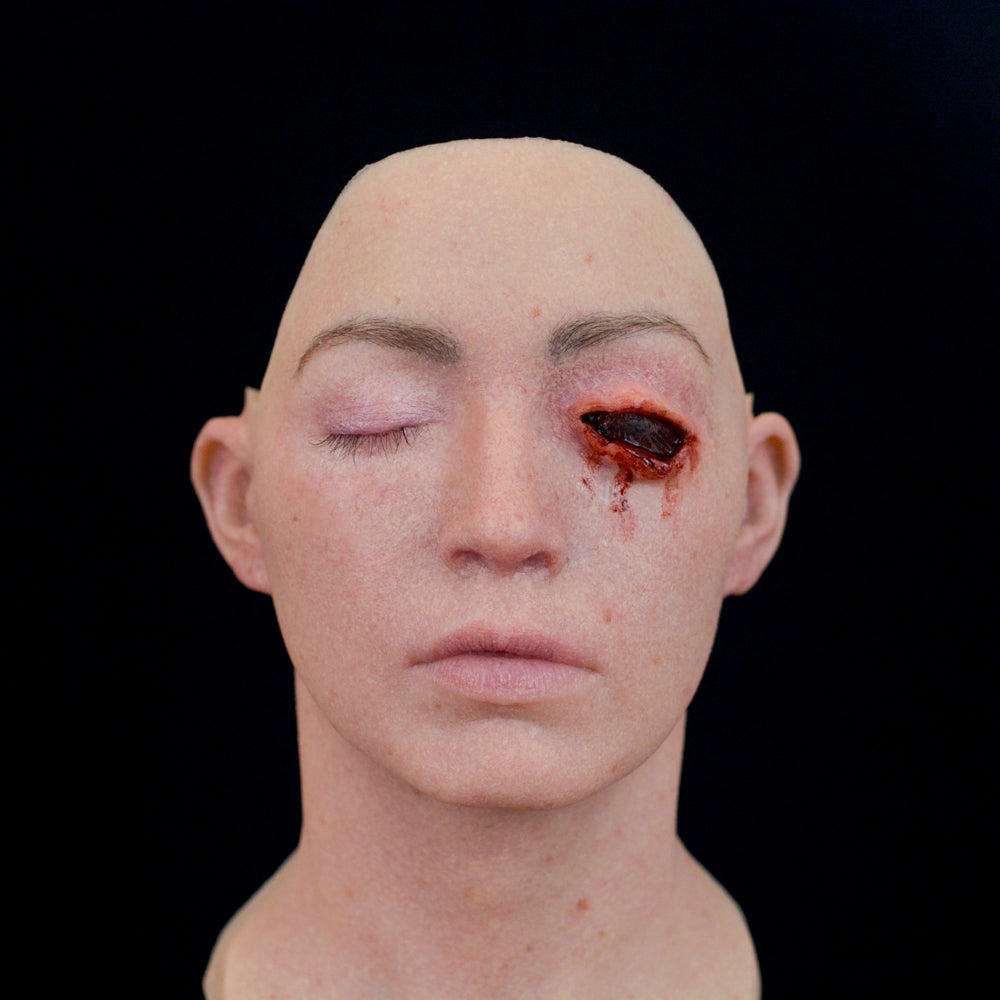 Gouged Left Eye