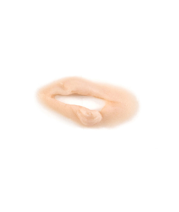 Gouged Left Eye
