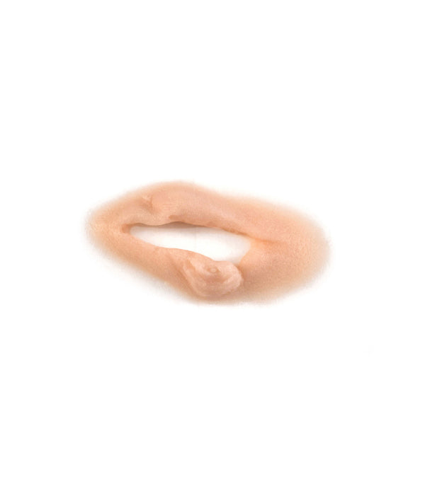 Gouged Left Eye