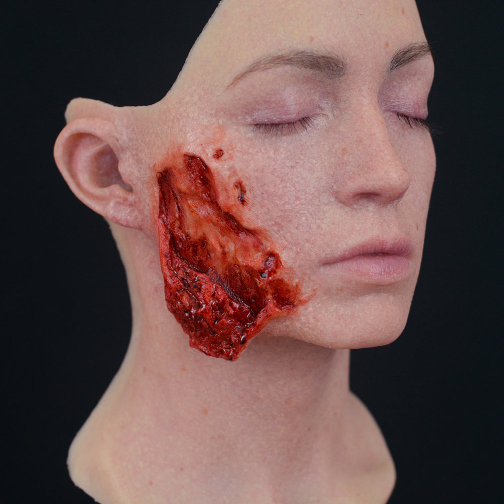 Right Torn Open Wound