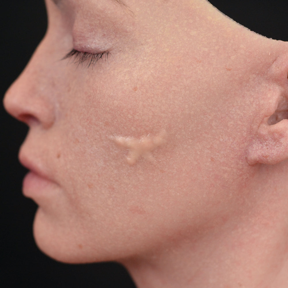 Serrated Knife Scar 2