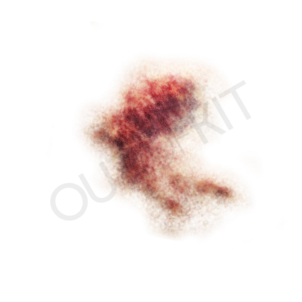 Bruise 1
