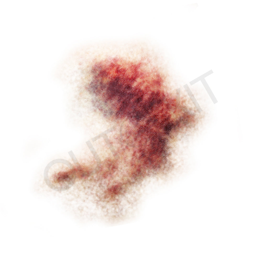 Bruise 1