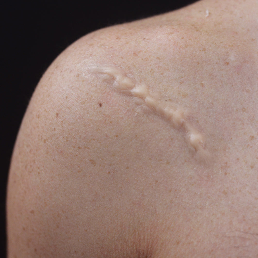 Gruesome Scar 1