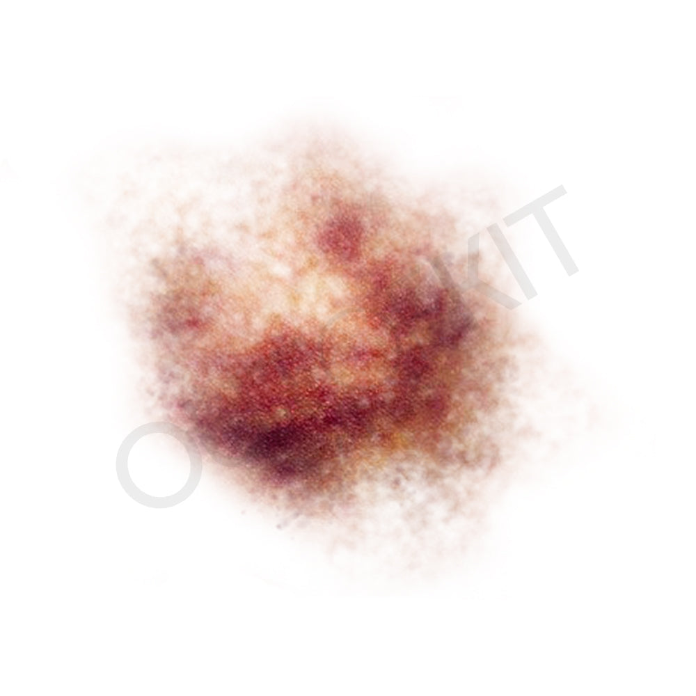 Bruise 2