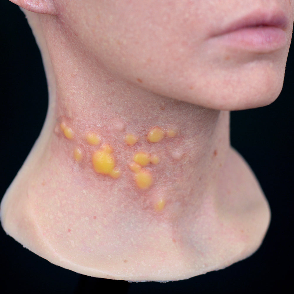 Extreme Infectious Disease 3