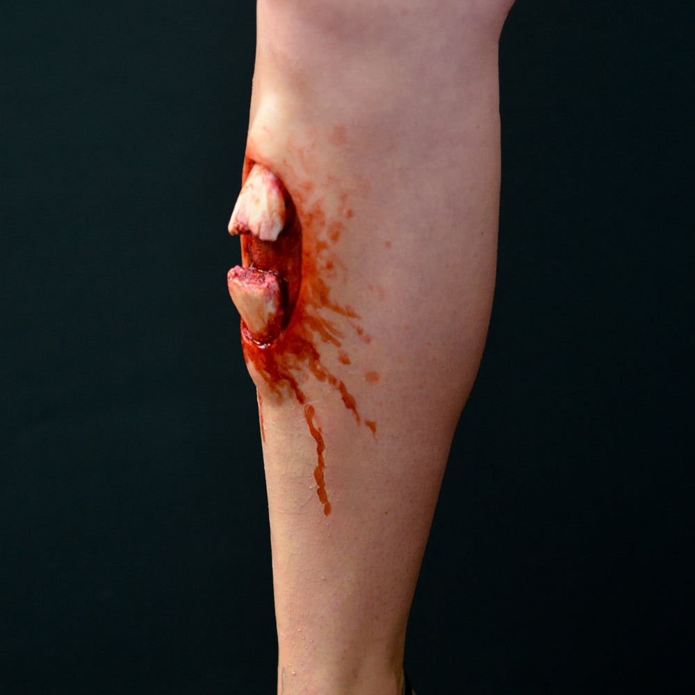 Compound Fracture 4