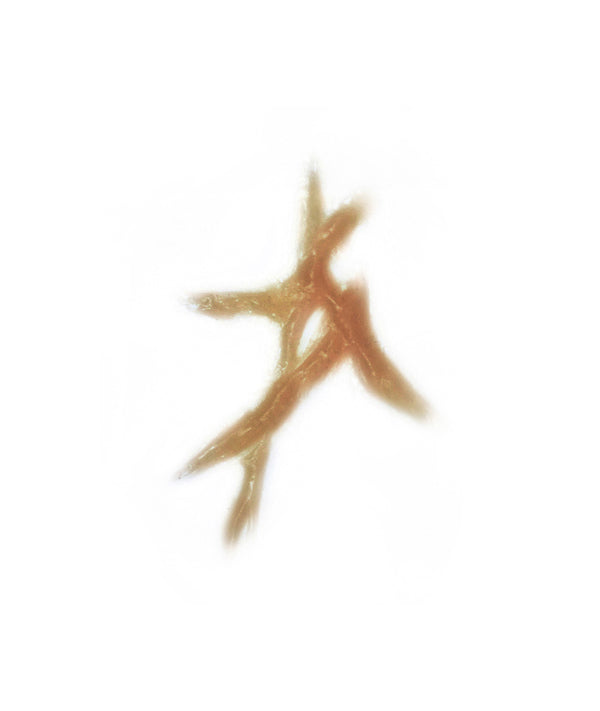 Dynamic Keloid Scar 1