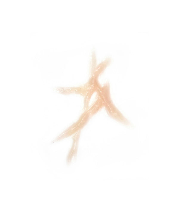 Dynamic Keloid Scar 1