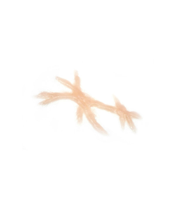 Dynamic Keloid Scar 2