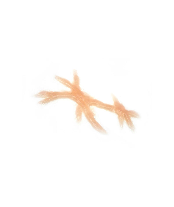 Dynamic Keloid Scar 2