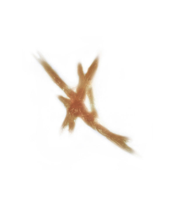 Dynamic Keloid Scar 3