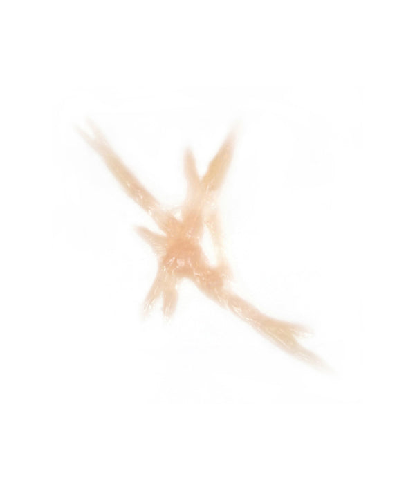 Dynamic Keloid Scar 3