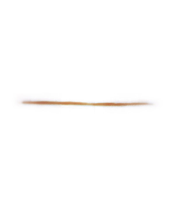 Laser cut Keloid Scar