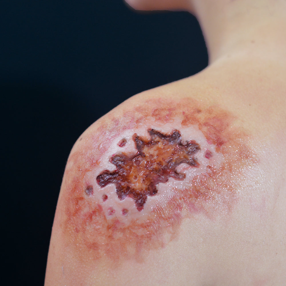 Acid Burn 3