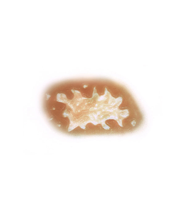 Acid Burn 3