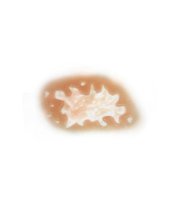 Acid Burn 3