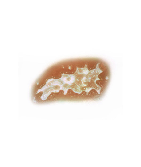 Acid Burn 5