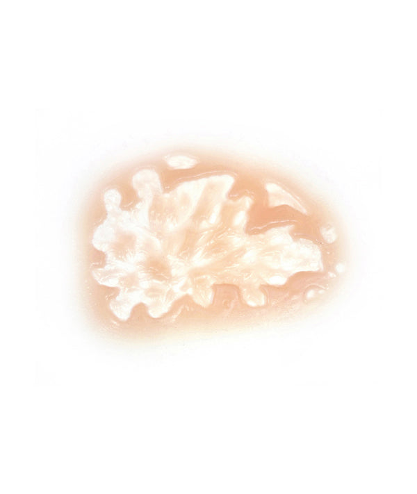 Acid Burn 6