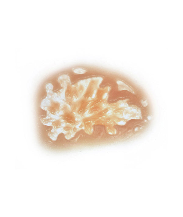 Acid Burn 6