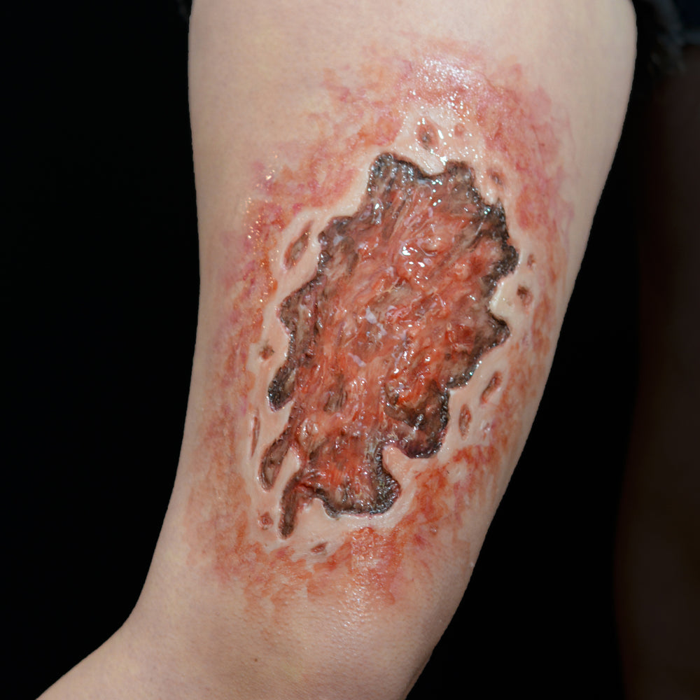 Acid Burn 8