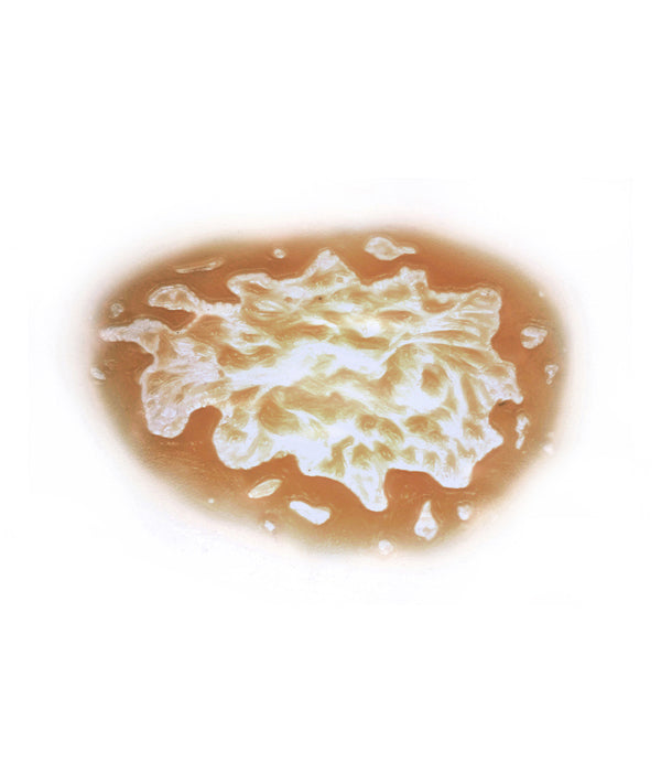 Acid Burn 8