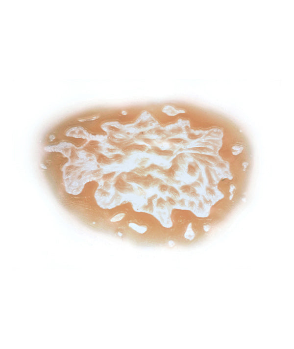 Acid Burn 8