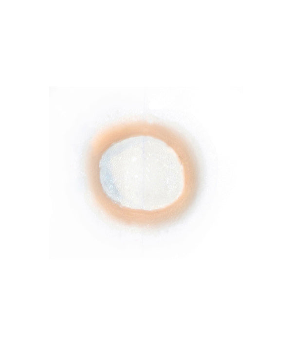 Ring Worm