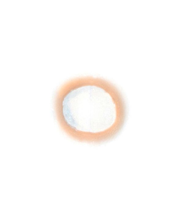 Ring Worm
