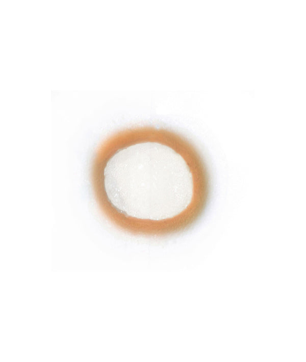 Ring Worm