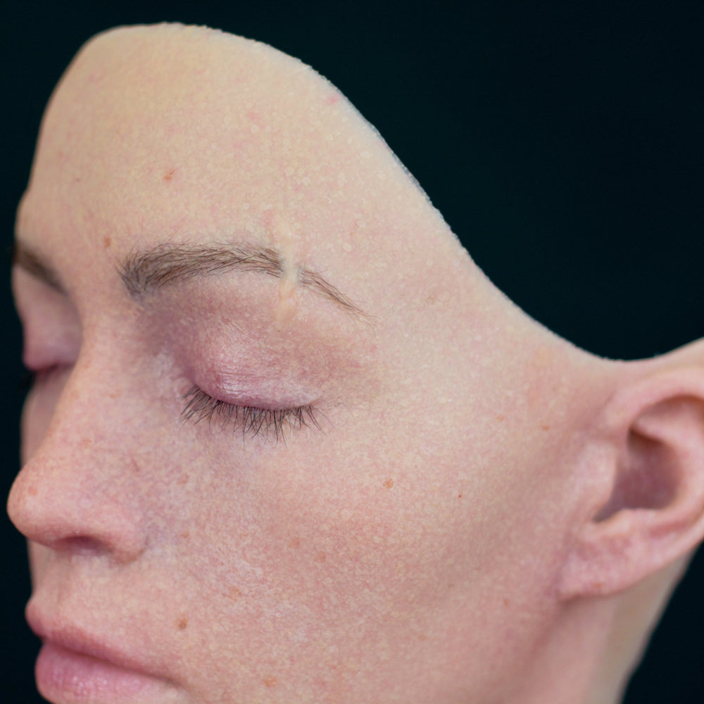 Above the Eye Scar 2