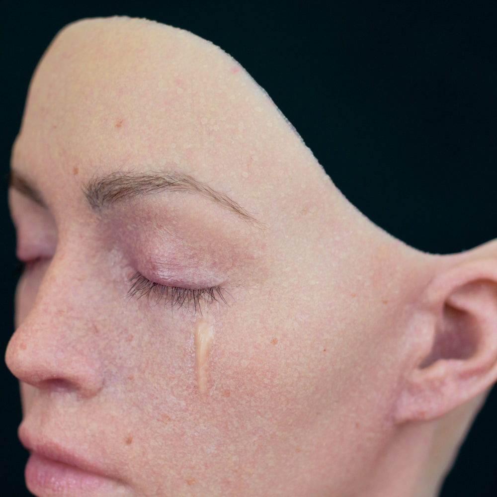 Below The Eye Scar 2