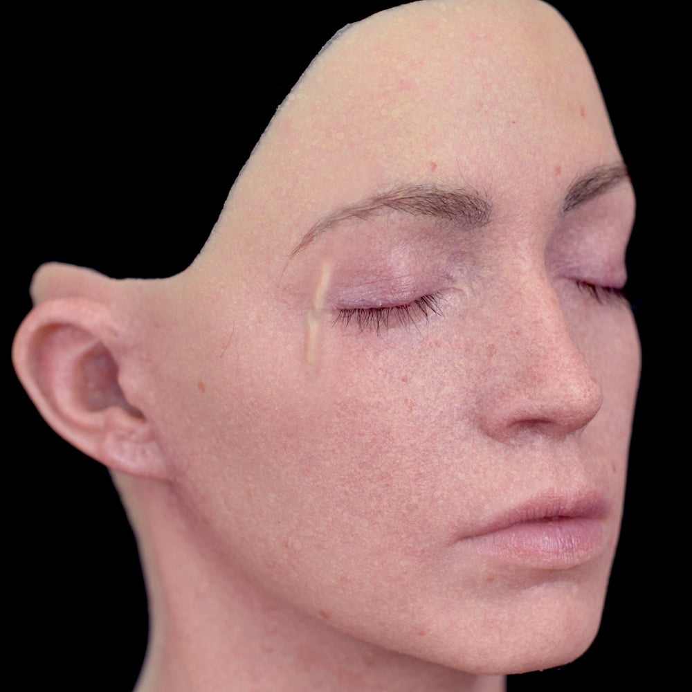 Below The Eye Scar 3